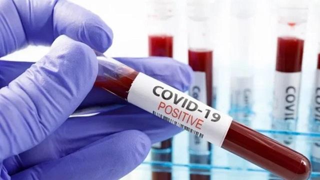 Covid-19 Update